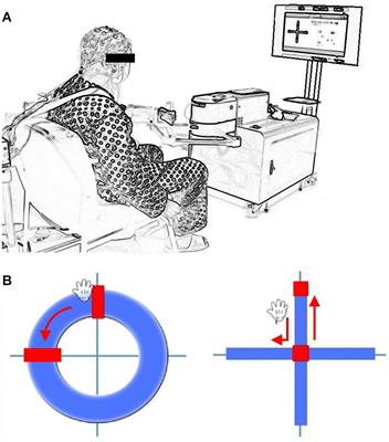 Dual Task Effects on Speed and Accuracy During Cognitive and Upper Limb Motor Tasks in Adults With Stroke Hemiparesis